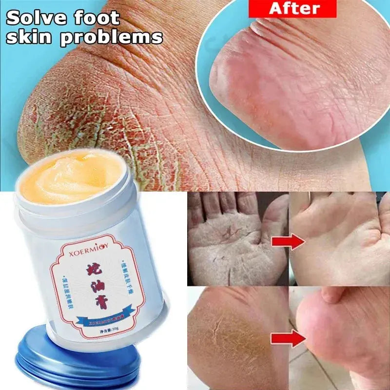 Beauty Product Herbal Anti Crack Foot Cream Heel Cracking Repair Products Exfoliation Dead Skin Removal Softening Moisturize - SPINGHAR