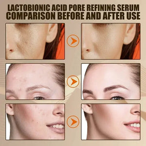 Lactobionic Acid Shrink Pores Facial Serum Firm Moisturizing Essence Liquid Repair Face Pores Beauty Skin Care Korean Cosmetics - SPINGHAR