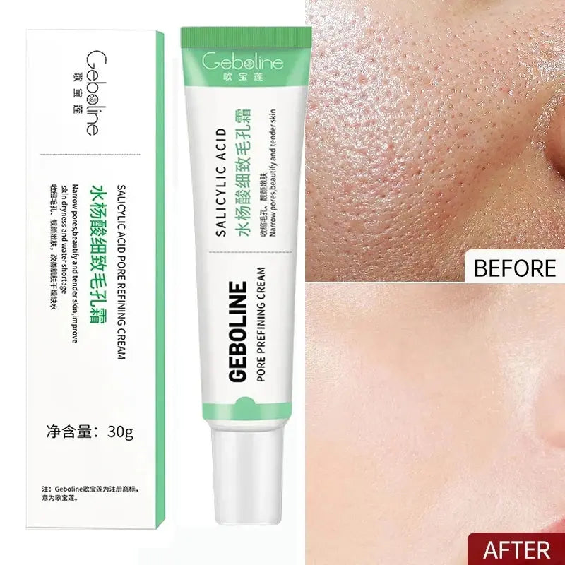 Salicylic Acid Pore Shrinking Cream Quick Elimination Large Pores Remove Blackehead Tighten Face Smooth Skin Korean Care Product - SPINGHAR