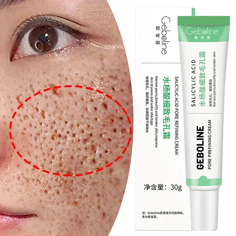 Salicylic Acid Pore Shrinking Cream Quick Elimination Large Pores Remove Blackehead Tighten Face Smooth Skin Korean Care Product - SPINGHAR