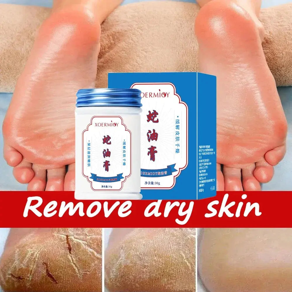 Beauty Product Herbal Anti Crack Foot Cream Heel Cracking Repair Products Exfoliation Dead Skin Removal Softening Moisturize - SPINGHAR