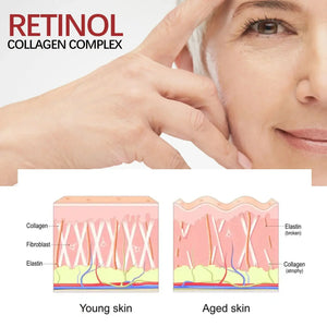 Retinol Wrinkle Remover Face Set Instant Firming Lifting Anti-Aging Serum Fade Fine Lines Whitening Korean Skin Care Products - SPINGHAR